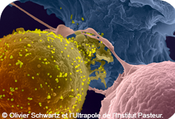 Lymphocytes infectés par le VIH-1. Les particules virales (en jaune) bourgeonnent à la surface d’une cellule infectée. Image réalisée en microscopique électronique à balayage 